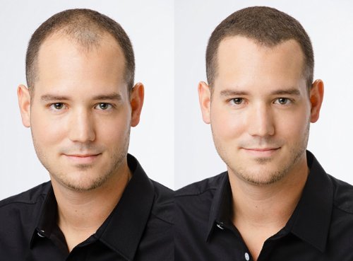 how to thicken and regrow your thinning hair